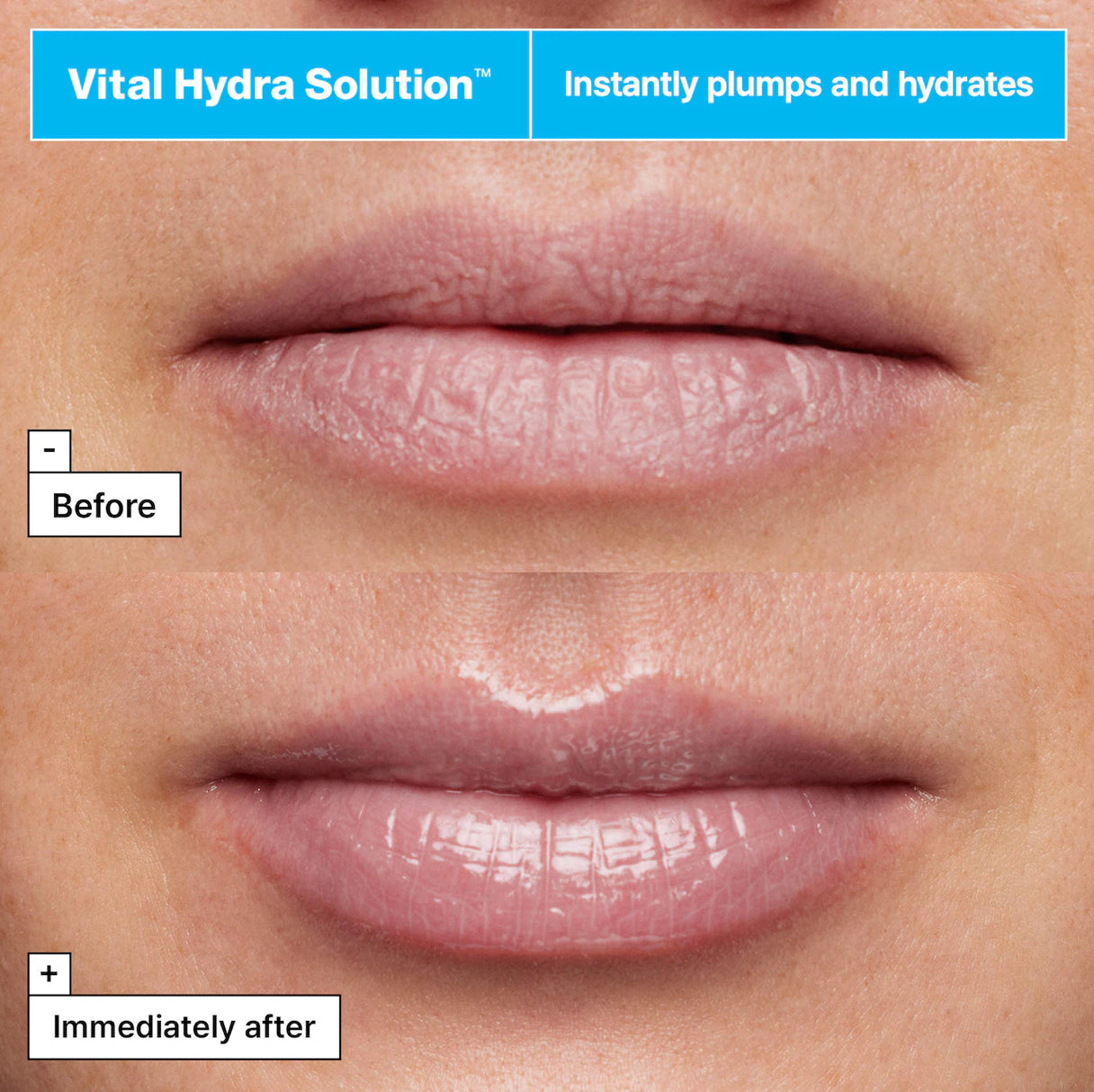 PREVENTA Sephora Favorites Lip Value Set