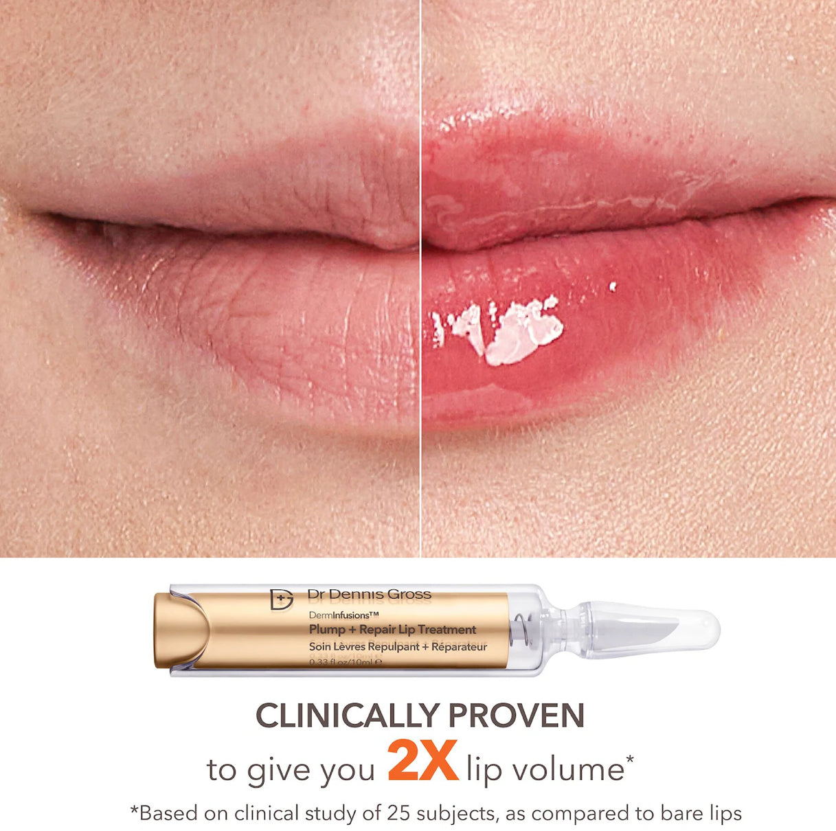 PREVENTA Sephora Favorites Lip Value Set