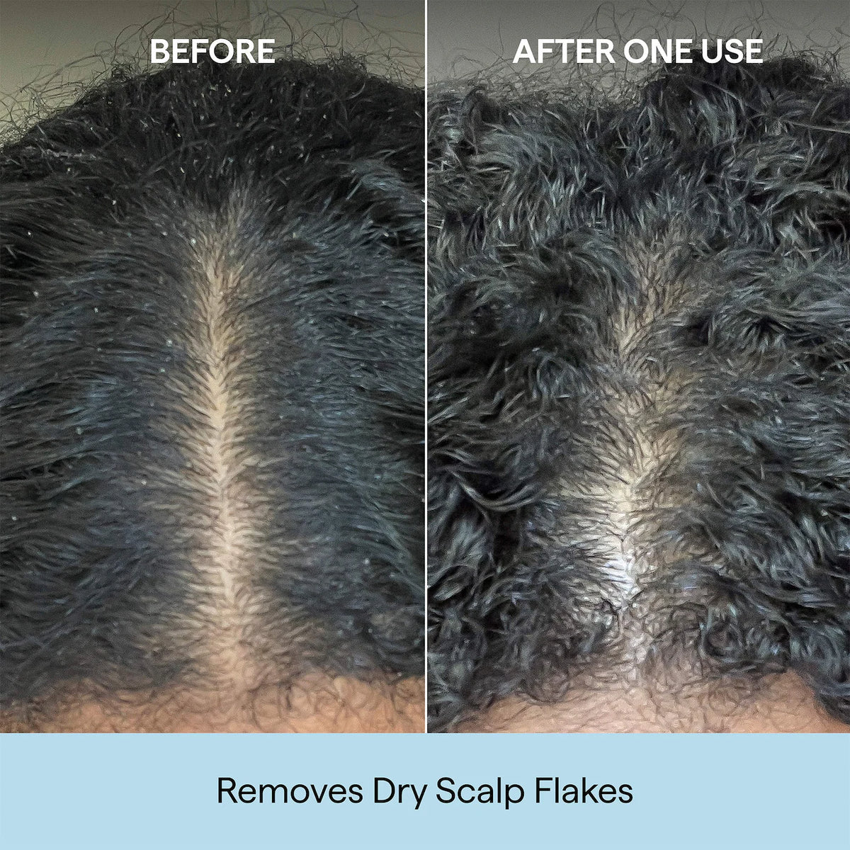 Briogeo- Scalp Revival Charcoal + Coconut Oil Micro-exfoliating Scalp Scrub Shampoo 30ml