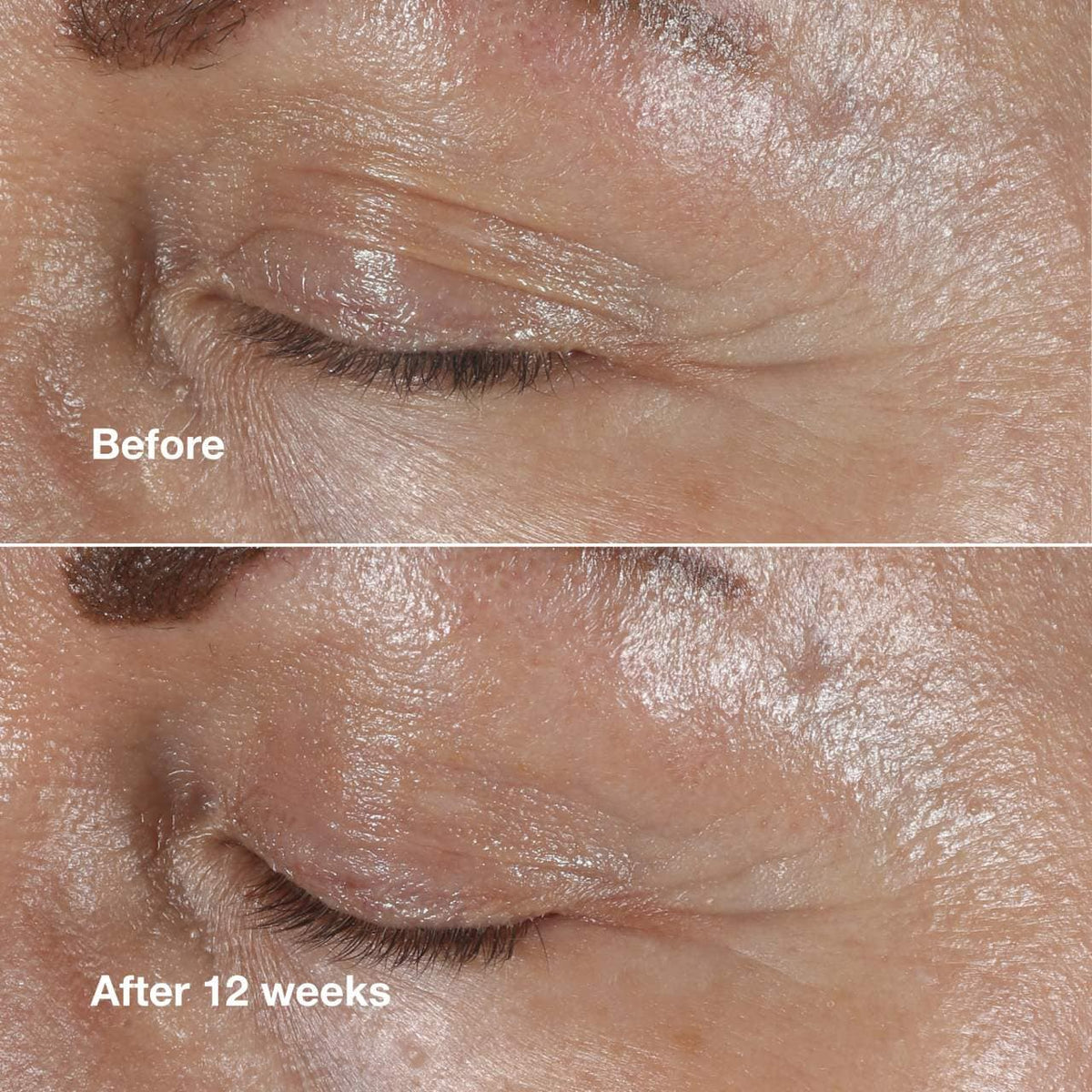 CLINIQUE- MINI Smart Clinical Repair™ Wrinkle Correcting Anti-Aging Eye Cream with Peptides 5ml