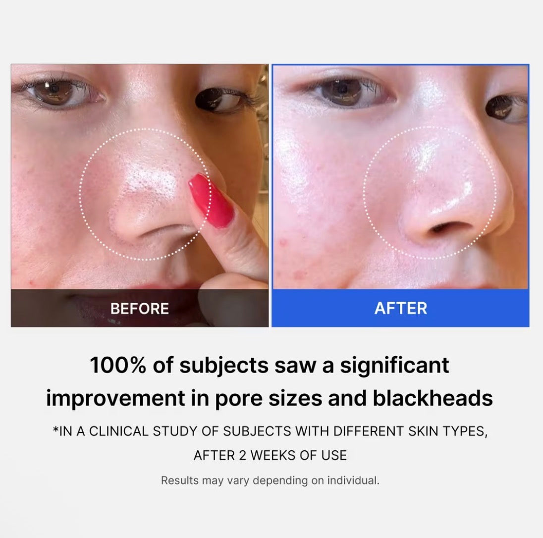 medicube-Zero Pore Pad