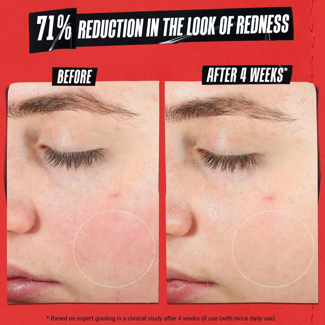 Kiehl's Since 1851- Ultra Facial Meltdown Recovery Cream Medicated 50ml